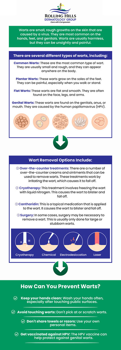 Common questions asked by patients: What are warts? How do warts spread? What are the treatment options for warts? Are wart treatments painful? For more information, contact us or request an appointment online. We are conveniently located at 449 Silver Spur Road Rolling Hills Estates, CA 90274. We serve patients from Rolling Hills Estate CA, Torrance CA, West Carson CA, Lomita CA, Palos Verdes Estates CA, Hermosa Beach CA, Manhattan Beach CA, Redondo Beach CA, and surrounding areas.
