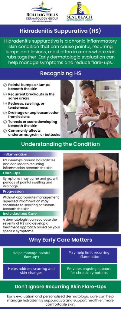 Common questions asked by patients: What is hidradenitis suppurativa (HS)? What are the symptoms of hidradenitis suppurativa? Is hidradenitis suppurativa contagious? Can hidradenitis suppurativa be prevented? For more information, contact us or request an appointment online. We serve patients from Rolling Hills Estate CA, Torrance CA, West Carson CA, Lomita CA, Palos Verdes Estates CA, Hermosa Beach CA, Manhattan Beach CA, Redondo Beach CA, Seal Beach CA, Rossmoor CA, Garden Groce CA, Santon CA, Westminister CA, and surrounding areas.